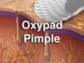 OxyPad